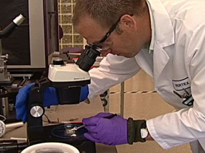 SEXUALITY: Νέα ελπίδα για την ηπατίτιδα C, μια συχνά κρυμμένη ασθένεια: Μέρος 2ο